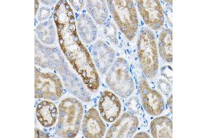 Immunohistochemistry of paraffin-embedded mouse kidney using GRPEL2 Rabbit pAb (ABIN6132810, ABIN6141437, ABIN6141438 and ABIN6224364) at dilution of 1:200 (40x lens). (GRPEL2 抗体  (AA 33-225))