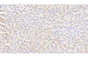 Detection of FTL in Bovine Liver Tissue using Polyclonal Antibody to Ferritin, Light Polypeptide (FTL) (FTL 抗体  (AA 1-175))