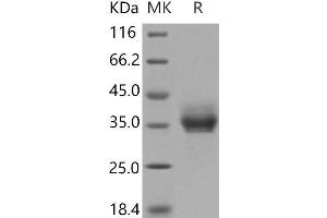 Western Blotting (WB) image for Epithelial Cell Adhesion Molecule (EPCAM) (Active) protein (His tag) (ABIN7195602)