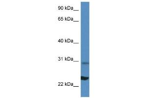 WB Suggested Anti-Rpl17 Antibody Titration: 1. (RPL17 抗体  (N-Term))