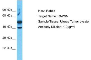 Host:  Rabbit  Target Name:  RAPSN  Sample Type:  Uterus Tumor lysates  Antibody Dilution:  1. (RAPSN 抗体  (C-Term))