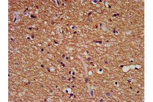 IHC image of ABIN7145619 diluted at 1:500 and staining in paraffin-embedded human brain tissue performed on a Leica BondTM system. (FHIT 抗体  (AA 2-147))