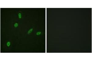Immunofluorescence (IF) image for anti-V-Ets erythroblastosis Virus E26 Oncogene Homolog 1 (Avian) (ETS1) (AA 11-60) antibody (ABIN2888658) (ETS1 抗体  (AA 11-60))