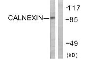 Western blot analysis of extracts from HeLa cells, treated with EGF 200ng/ml 30', using Calnexin (Ab-583) Antibody. (Calnexin 抗体  (AA 543-592))