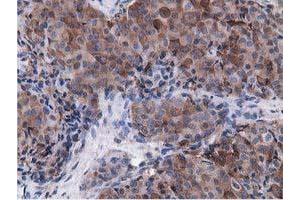 Immunohistochemical staining of paraffin-embedded Human pancreas tissue using anti-VWA5A mouse monoclonal antibody. (VWA5A 抗体)