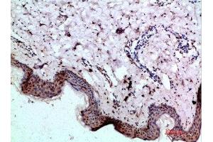 Immunohistochemical analysis of paraffin-embedded human-skin, antibody was diluted at 1:200 (BMP1 抗体  (AA 131-180))
