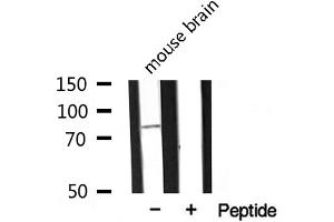 Western blot analysis of extracts from mouse Brian, using MARK2 antibody. (MARK2 抗体  (Internal Region))