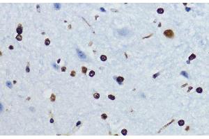 Immunohistochemistry of paraffin-embedded Mouse spinal cord using Acetyl-Histone H4-K12 Polyclonal Antibody at dilution of 1:200 (40x lens). (Histone H4 抗体  (acLys12))