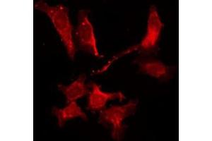 ABIN6278549 staining Hela by IF/ICC. (Adenosine A2b Receptor 抗体  (Internal Region))