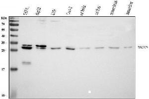 Western blot analysis of MED8 using anti-MED8 antibody (ABIN5519031). (MED8 抗体  (AA 1-195))