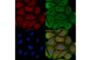 ABIN6257415 and ABIN6275226 staining Hela cells by IF/ICC. (PGRMC2 抗体  (C-Term))