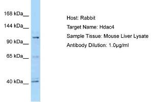 WB Suggested Anti-Hdac4 Antibody   Titration: 1. (HDAC4 抗体  (C-Term))