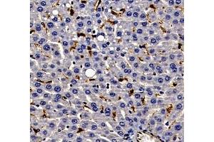 Immunohistochemistry of paraffin embedded rat liver using ANXA3 (ABIN7073065) at dilution of 1: 300 (400x lens) (Annexin A3 抗体)