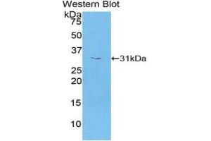 Detection of Recombinant PRKAg1, Human using Polyclonal Antibody to Protein Kinase, AMP Activated Gamma 1 (PRKAg1) (PRKAG1 抗体  (AA 70-300))