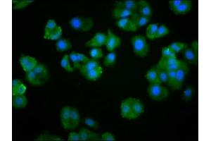 Immunofluorescence staining of HepG2 cells with ABIN7174103 at 1:266, counter-stained with DAPI. (PTPN22 抗体  (AA 1-179))