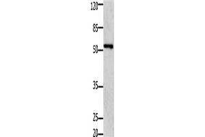Western Blotting (WB) image for anti-GDNF Family Receptor alpha 1 (GFRA1) antibody (ABIN2431438) (GFRA1 抗体)