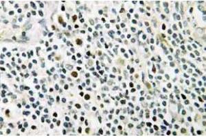 Immunohistochemistry (IHC) analyzes of NPM antibody in paraffin-embedded human tonsil tissue. (NPM1 抗体)