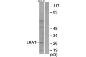 Western blot analysis of extracts from COLO205 cells, using LRAT Antibody. (LRAT 抗体  (AA 111-160))