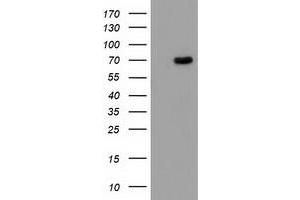 HEK293T cells were transfected with the pCMV6-ENTRY control (Left lane) or pCMV6-ENTRY BCHE (Right lane) cDNA for 48 hrs and lysed. (Butyrylcholinesterase 抗体)