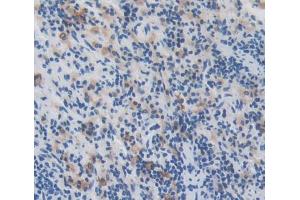 Used in DAB staining on fromalin fixed paraffin- embedded Kidney tissue (Manic Fringe 抗体  (AA 56-309))