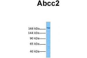 Western Blotting (WB) image for anti-ATP-Binding Cassette, Sub-Family C (CFTR/MRP), Member 2 (ABCC2) (Middle Region) antibody (ABIN2781497)