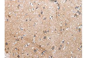 The image on the left is immunohistochemistry of paraffin-embedded Human brain tissue using ABIN7193075(XKR4 Antibody) at dilution 1/20, on the right is treated with synthetic peptide. (XKR4 抗体)