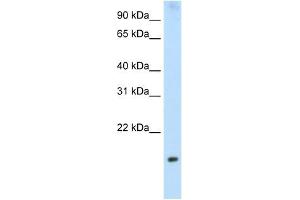 PPP1R8 antibody used at 2. (PPP1R8 抗体)