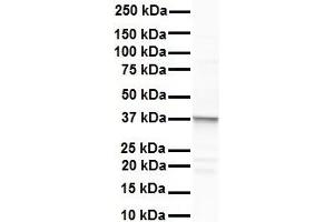 Western Blotting (WB) image for anti-Excision Repair Cross-Complementing Rodent Repair Deficiency, Complementation Group 8 (ERCC8) (C-Term) antibody (ABIN2777347)