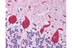 Anti-TLR10 antibody IHC of human brain, cerebellum. (TLR10 抗体)