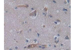 Detection of JAG2 in Human Cerebrum Tissue using Polyclonal Antibody to Jagged 2 Protein (JAG2) (JAG2 抗体  (AA 714-981))