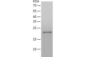 Western Blotting (WB) image for Vesicle-Associated Membrane Protein 7 (VAMP7) (AA 1-188) protein (His tag) (ABIN7125713) (VAMP7 Protein (AA 1-188) (His tag))