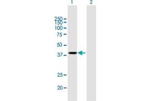 Western Blot analysis of PSG2 expression in transfected 293T cell line by PSG2 MaxPab polyclonal antibody. (PSG2 抗体  (AA 1-335))