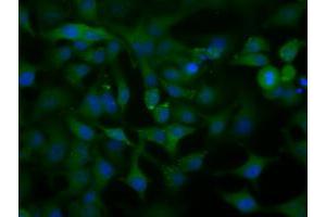 Image no. 10 for anti-Acetyl-CoA Acetyltransferase 2 (ACAT2) antibody (ABIN1496403) (ACAT2 抗体)