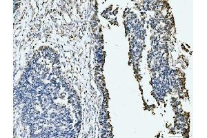 IHC analysis of MCM6 using anti-MCM6 antibody (ABIN7600038). (MCM6 抗体  (AA 14-821))
