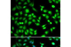 Immunofluorescence analysis of HeLa cells using CDKN2D Polyclonal Antibody (CDKN2D 抗体)