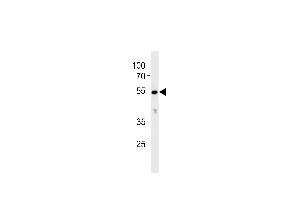 Western blot analysis in K562 cell line lysates (35ug/lane). (CYP26C1 抗体  (C-Term))