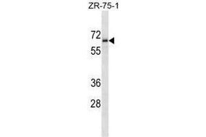 TM117 Antibody (C-term) western blot analysis in ZR-75-1 cell line lysates (35 µg/lane). (TMEM117 抗体  (C-Term))