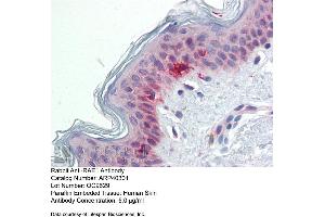 Immunohistochemistry with Human Skin lysate tissue at an antibody concentration of 5. (RAE1 抗体  (C-Term))