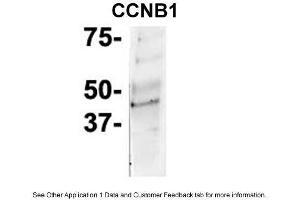 IP Suggested Anti-CCNB1 Antibody Positive Control: NT2 CELL/BRAIN TISSUE (Cyclin B1 抗体  (C-Term))