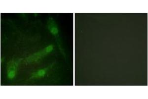 Immunofluorescence analysis of HeLa cells, using Smad2 (Phospho-Thr220) Antibody.