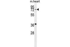 CCDC38 Antibody (Center) western blot analysis in mouse heart tissue lysates (35µg/lane). (CCDC38 抗体  (Middle Region))