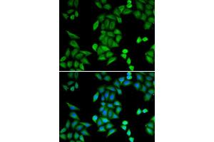 Immunofluorescence analysis of MCF-7 cells using RBPJ antibody (ABIN5973315). (RBPJ 抗体)
