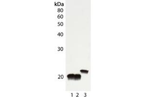 Western blot analysis of Cu/Zn SOD, pAb : Lane 1: Rat liver tissue lysate, Lane 2: Mouse liver tissue lysate, Lane 3: HeLa cell lysate . (SOD1 抗体)