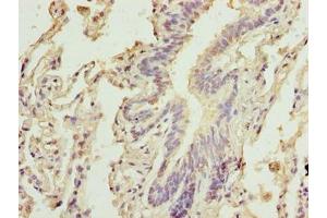 Immunohistochemistry of paraffin-embedded human lung tissue using ABIN7146547 at dilution of 1:100 (Calpain 6 抗体  (AA 195-494))