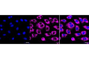 Immunocytochemical staining of H9c2 cells with Prostaglandin E receptor 2 antibody (ABIN7799932), 1:1,000).