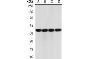 Western blot analysis of IL-23R expression in K562 (A), HepG2 (B), mouse intestine (C), mouse spleen (D) whole cell lysates. (IL23R 抗体)