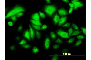 Immunofluorescence of monoclonal antibody to KRT17 on HeLa cell. (KRT17 抗体  (AA 1-432))
