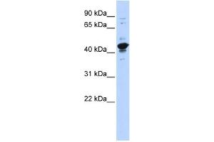 WB Suggested Anti-RBMXL2 Antibody Titration:  0. (RBMXL2 抗体  (Middle Region))