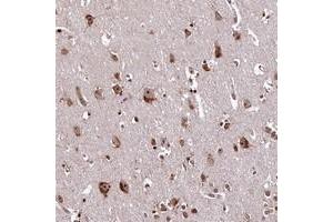 Immunohistochemical staining of human cerebral cortex with PDS5B polyclonal antibody  at 1:200-1:500 dilution. (PDS5B 抗体)