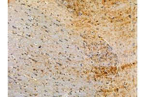ABIN7095021 and ABIN7099077 at 1/100 staining rat brain tissue by IHC-P. (PI15 抗体)